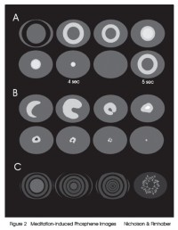 Meditation Induced Phosphenes